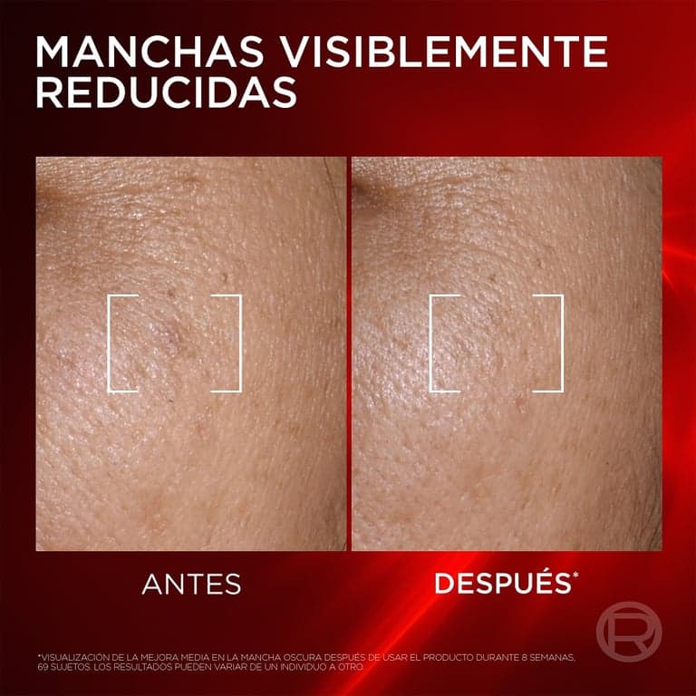 L'Oréal París    

            Revitalift Laser Sérum Antiedad - Image 5