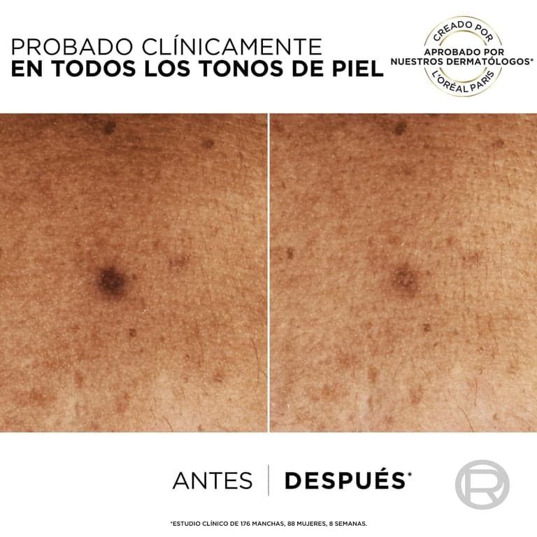 L'Oréal París    

            Bright Reveal Sérum con Niacinamida Anti Manchas - Image 5