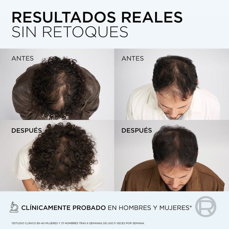 L'Oréal París    

            Elvive Growth Booster Champú Anticaída - Image 7