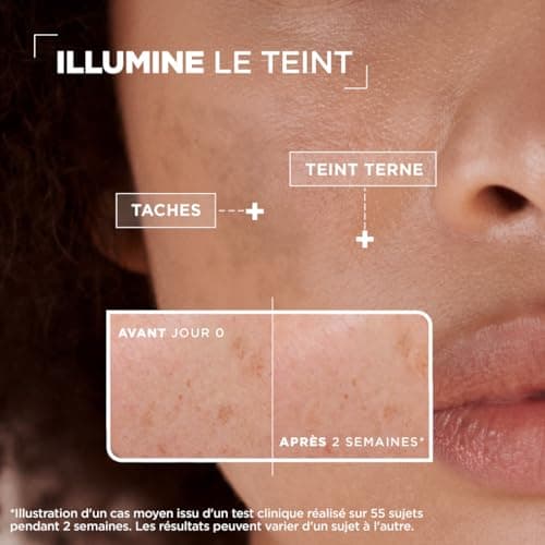 Mixa - Sérum Concentré Anti-Taches - Pour les Teints Ternes - Enrichi en Vitamine C et Acide Glycolique - 30 ml - Image 4