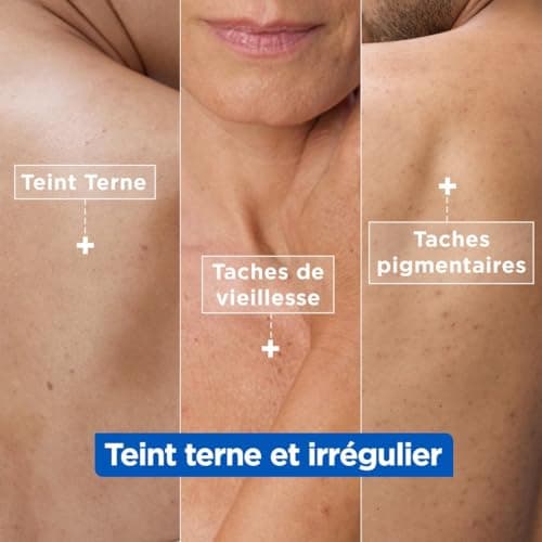 Mixa - Crème Niacinamide Correction Éclat - Crème Hydratante Anti-Taches au Beurre de Karité, à la Niacinamide et à la Vitamine C - Adaptée au Visage, Corps et Mains - Hypoallergénique - 400ml - Image 5