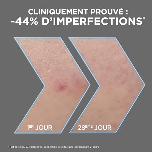 Garnier - Pure Active - Sérum Anti-Points Noirs & Imperfections au Charbon - 4% Niacinamide, Acide Salicylique & Acide Lactique - Peaux Grasses à Tendance Acnéique - Vegan & Cruelty Free - 30 ml - Image 4