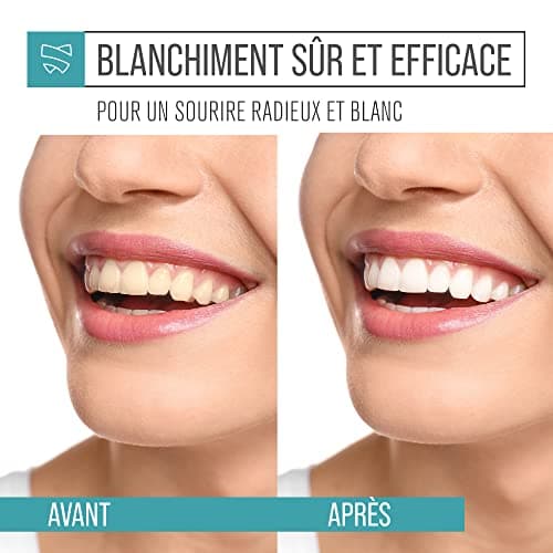 Activated Charcoal Dental Whitening Powder, Natural Teeth Whitening Powder for Cleansing, Gum and Enamel Safe, 100g - Image 6