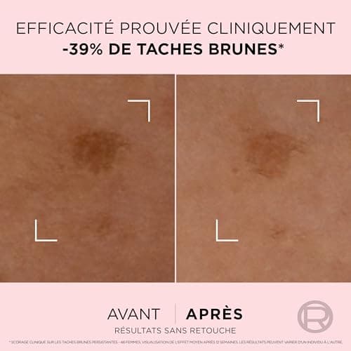 L'Oréal Paris Age Perfect Golden Age Correcting Serum for Mature Skin 30 ml - Image 6