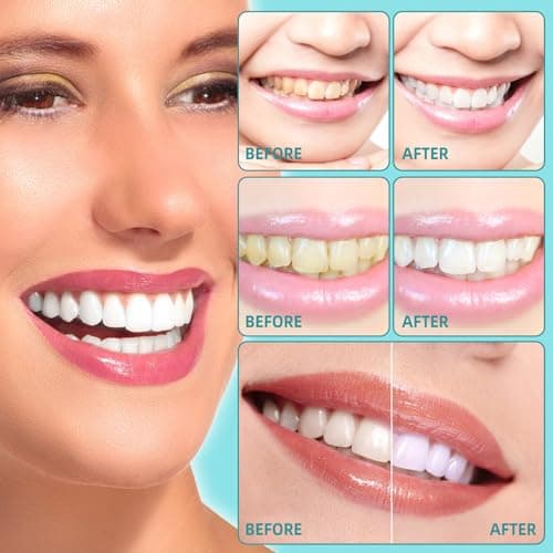 Mint Oil Pulling Mouthwash with Tongue Scraper - Natural Coconut Oil Puller for Teeth Whitening, Fresh Breath, Whitening Teeth and Gums Plus (474ml2pack) - Image 4