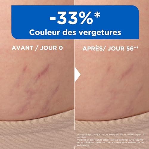 Mixa - Huile Anti-Vergetures - 30% d’Omégas 6 & 9 - Réduit la Couleur, la Texture et l’Épaisseur des Vergetures Post-Grossesse ou Variations de Poids et de Taille - 100 ml - Image 4