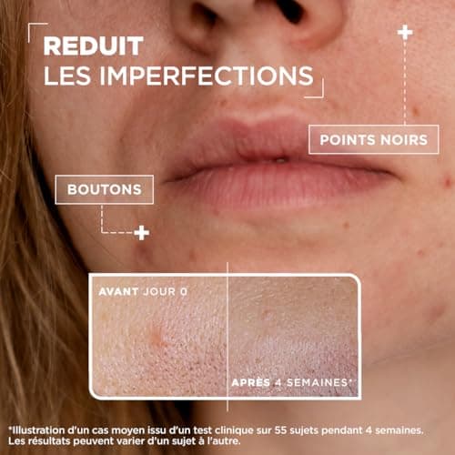 Mixa Sérum Concentré Anti-Imperfections, Sérum Visage avec Niacinamide et Acide Salicylique - Réduit Boutons, Points Noirs, Pores Resserrés, Convient aux Peaux Sensibles et à Imperfections, 30ml - Image 4
