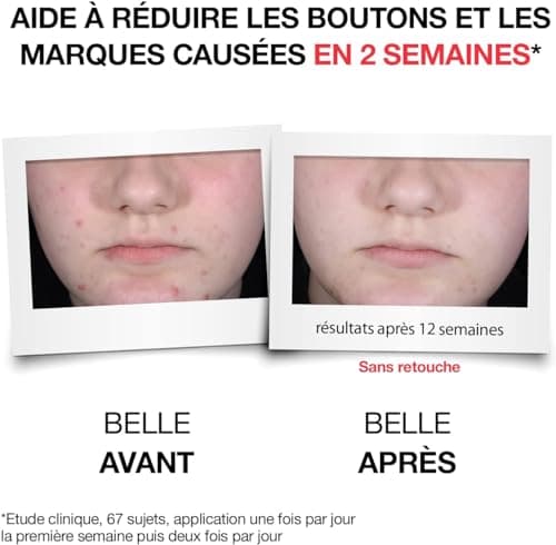 Neutrogena | Sérum Visage Quotidien Anti-Boutons+ (tube de 30 ml) – Soin visage à l'acide salicylique + 10% AHA/PHA – Sérum anti-imperfections sans parfum pour aider à éliminer les boutons - Image 5
