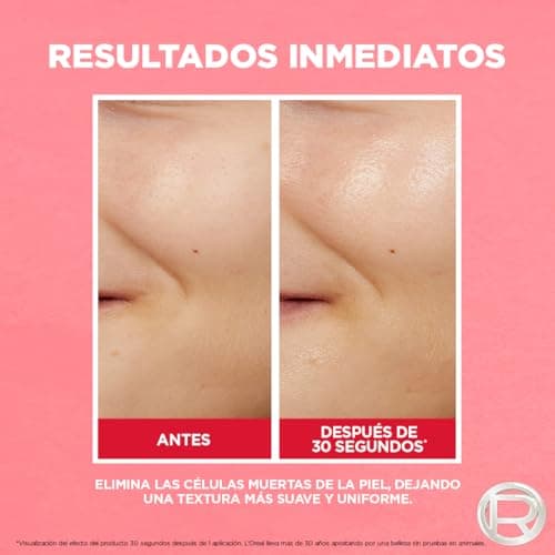 L'Oréal Paris Revitalift Tónico Efecto Peeling Ácido Glicólico 180 ml - Image 6