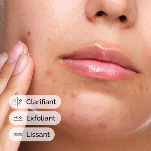 The Ordinary Salicylic Acid Solution 2%, Targeted Serum for Blemish-Prone Skin, 30 ml - Image 6