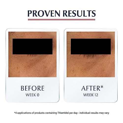 Eucerin Crème contour des yeux anti-pigmentation pour les cernes, soin illuminateur des yeux, correction des cernes, pour tous types de peau, 15 ml - Image 8