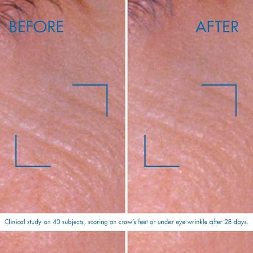 BIOTHERM - Blue Pro Retinol Eye Cream - Anti-Aging Eye Cream with Retinol - Anti-Wrinkle - Eye Contour - 15 ml - Image 6