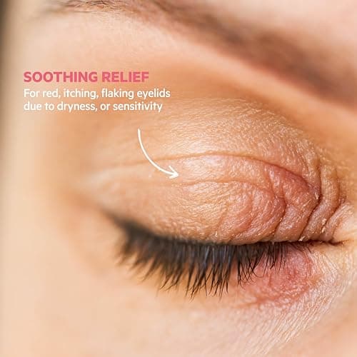 SVR Palpebral Crème by Topialyse – Soothing Anti-Scratch Care – For Sensitive, Dry and Irritated Eyelids – Hyaluronic Acid, Omega 3-6-10 – 15 ml - Image 3