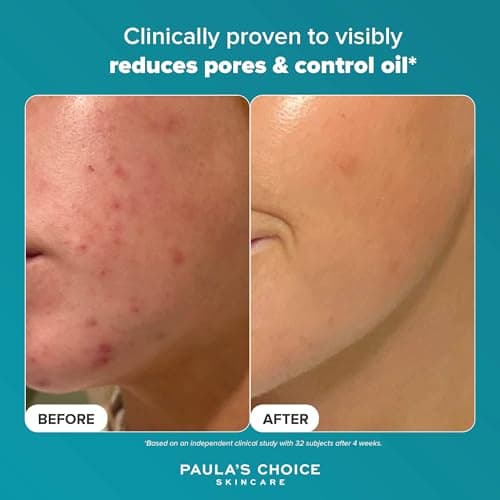 Paula's Choice SKIN PERFECTING 2% BHA Lotion Exfoliante - Gommage Visage avec Acide Salicylique - Réduire les Points Noirs & Pores Dilatés - pour Peau Mixte et Peau Grasse - 30 ml - Image 7