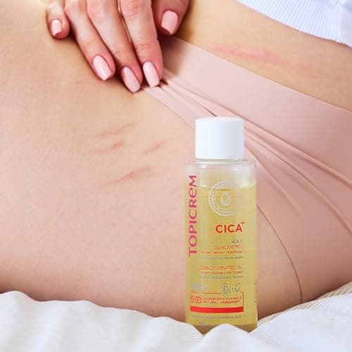 Topicrem - CICA+, Stretch Marks and Scars Concentrated Oil - Attenuated, Helps Prevent, Soothes, Moisturizes 24h - Face and Body Care for Sensitive Skin - Non Greasy, Non Sticky Finish - 100ml - Image 4