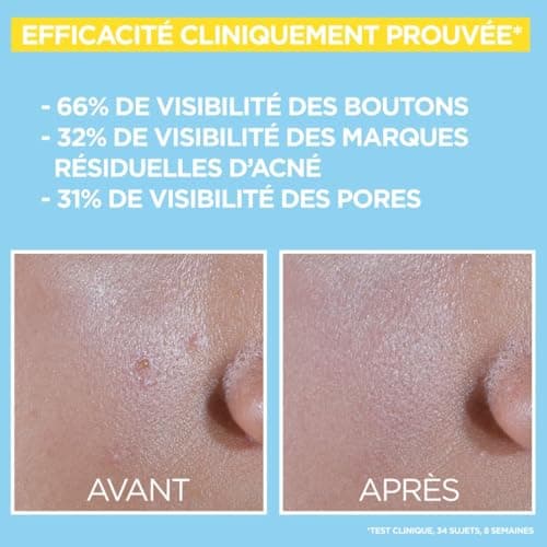 Garnier Pure Active Anti-UV Quotidien anti-imperfections SPF 50+ 40ml - Image 8