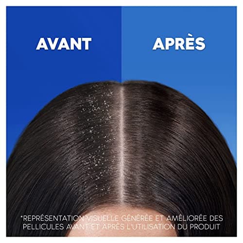 Head & Shoulders Après-shampooing pour cheveux et cuir chevelu Classic, Protection Renforcée Contre Les Pellicules, Hydratation en profondeur, Testé Sous Contrôle Dermatologique, 220ml - Image 3