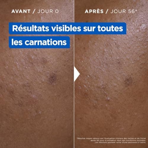 Mixa - Crème Niacinamide Correction Éclat - Crème Hydratante Anti-Taches au Beurre de Karité, à la Niacinamide et à la Vitamine C - Adaptée au Visage, Corps et Mains - Hypoallergénique - 400ml - Image 7