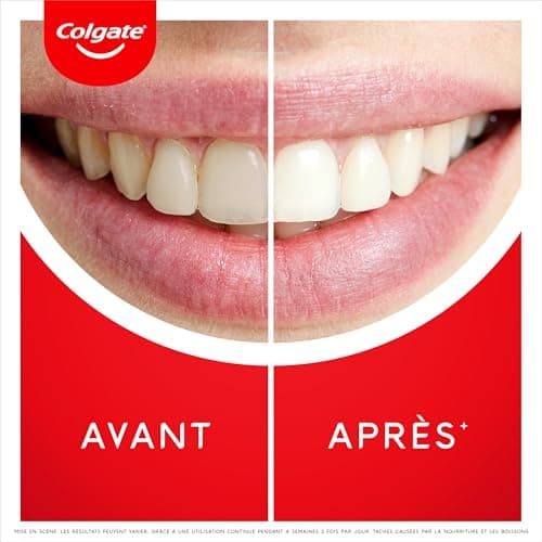 COLGATE - Dentifrice Max White Ultra Blancheur - Nettoyage en profondeur - 75ml - Image 5