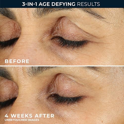 RoC Retinol Correxion Crème contour des yeux, mini pour cernes et poches, crème quotidienne, crème anti-âge, soin lissant, 750 ml - Image 8