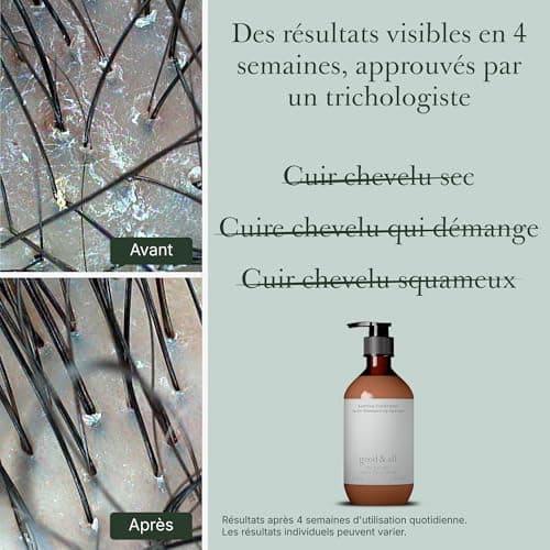 Good&All Après-Shampooing Anti-Démangeaisons, Cuirs Chevelus Irrité, Sec & Sensibles - Arbre à Thé, Menthe Poivrée - Sans Sulfate, Silicone, Paraben, Parfum - 400ml - Image 3