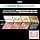 L'Oreal Paris Permanent Hair Color, Long-Lasting Shine and Intense Colour, Up to 8 Weeks, Preference Vivids (Colorista), 9.214 Rose Gold, 1 Pack - Image 3