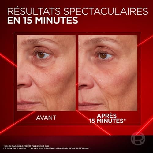 L'Oréal Paris Anti-Aging Eye Contour Cream - Reduces Wrinkles, Puffiness, Swelling and Lack of Firmness of the Eye Contour - All Skin Types - Revitalift Laser Eye Bag Instant Eraser - 15 ml - Image 5