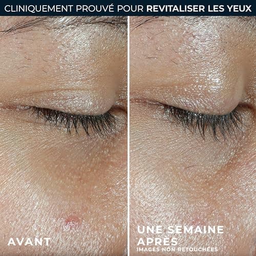 RoC - Multi Correxion Renouveau + Eclat Baume pour les yeux - Contient de la vitamine C - Hypoallergénique - 4 g - Image 7