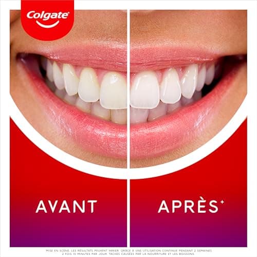 COLGATE - Max White Ultimate LED Whitening Kit | Whitening in 10 Minutes* | Removes up to 20 Years of Stains | Soft LED Whitening Device | Whitening Serum with New Precise Applicator - Image 8