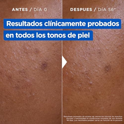 Mixa Crème Hydratante Anti-Taches, Pour Peau Sèche et Terne, Peau Hydratée pendant 48H, Teint Lumineux et Uniforme, Avec 9% de Niacinamide, Vitamine C et Beurre de Karité, Niacinamide Bright, 400 ml - Image 6